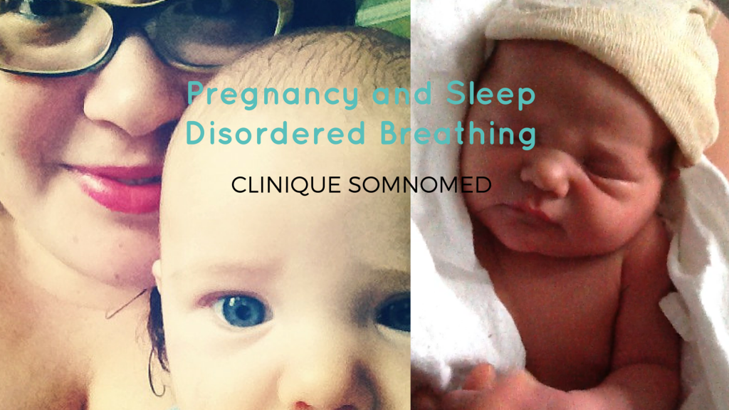 Pregnancy and sleep-disordered breathing by Clinique Somnomed