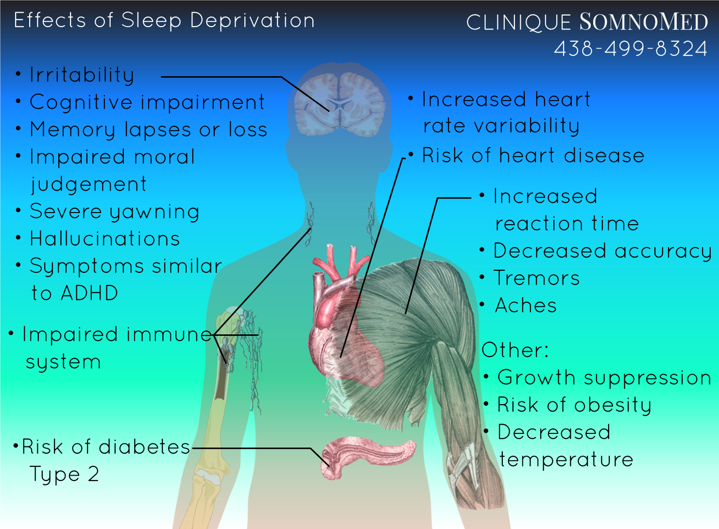 Effects of sleep depirvation