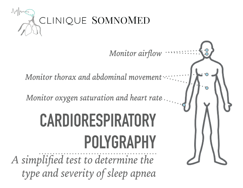 Clinique Somnomed Cardiorespiratory Polygraphy