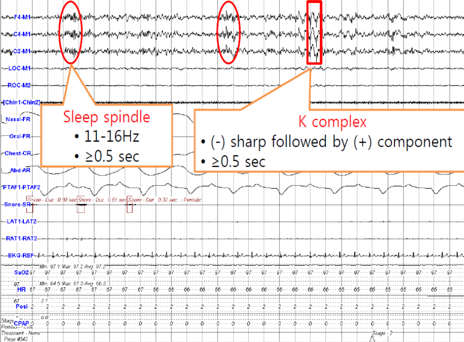 Clinique Somnomed EEG N2
