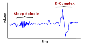 Clinique Somnomed Sleep Spindle K Complex